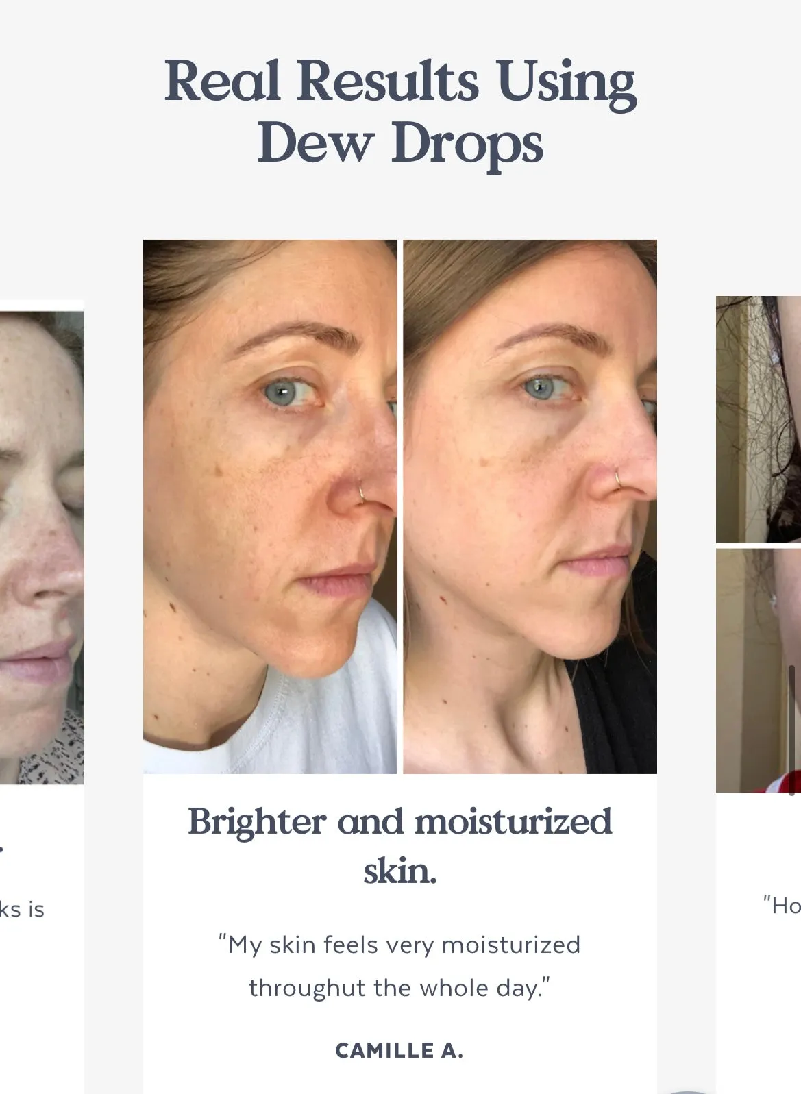 Dew Drops Serum